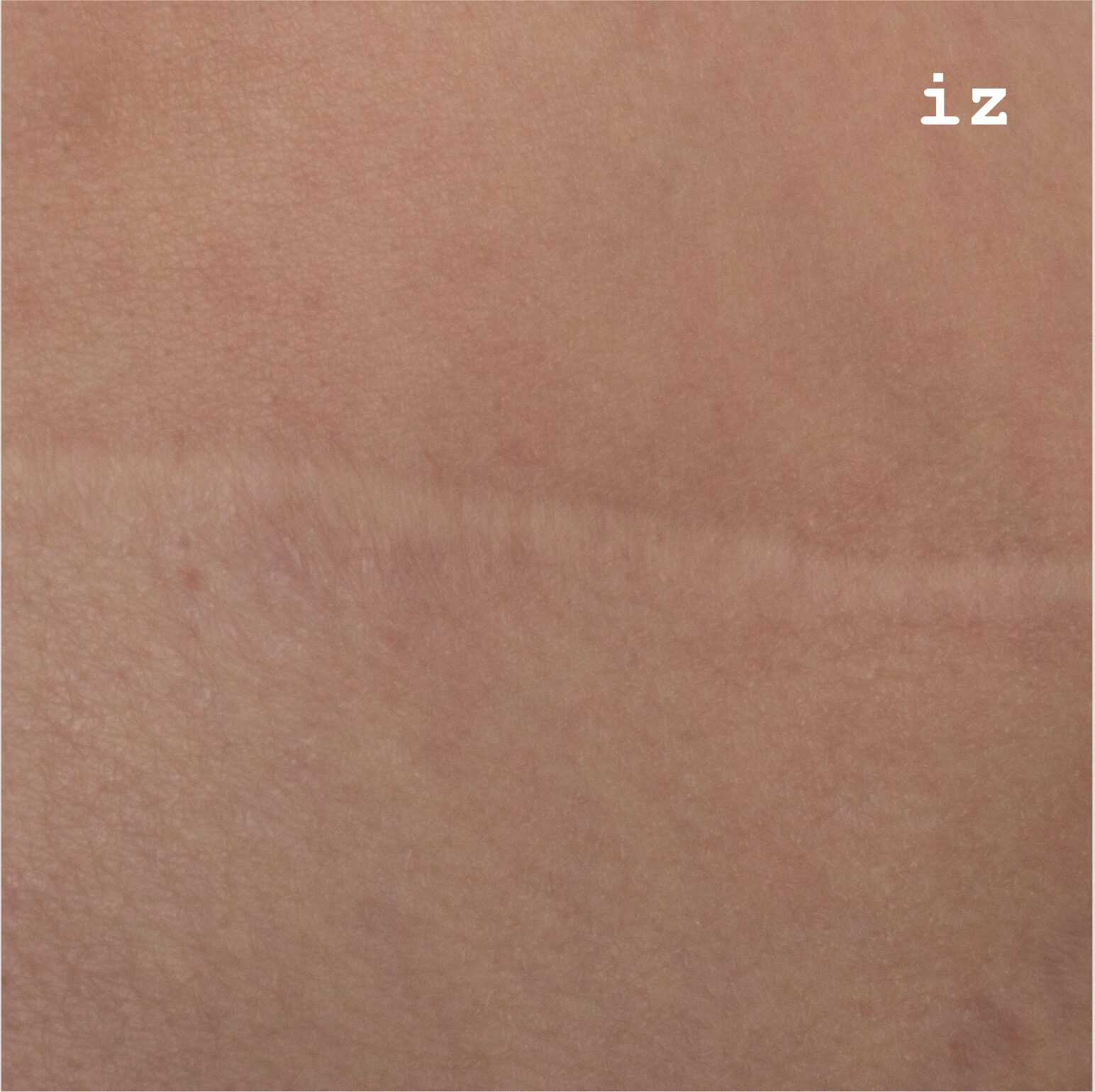 Scar, image 1