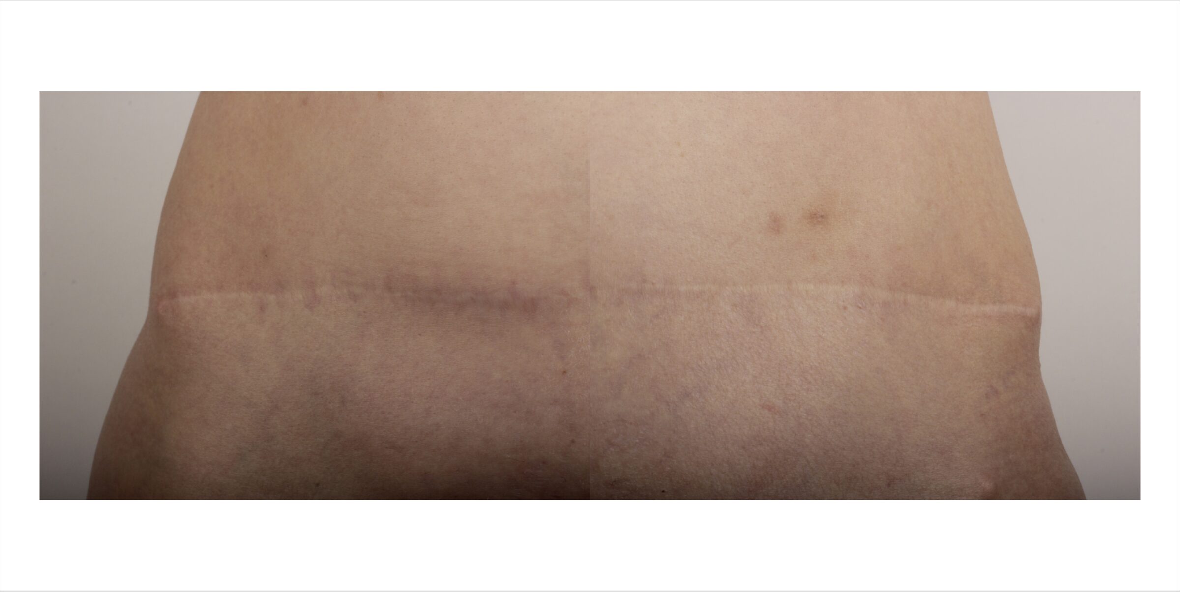 Scar, image 5