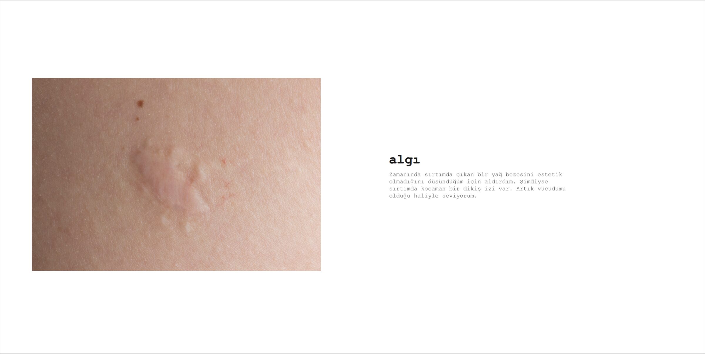 Scar, image 6